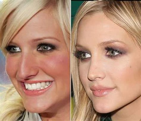 hillary duff nose job|15 Celebrities Who Have Been Honest About Their Nose Jobs